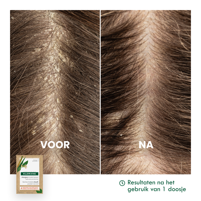 Resultaten Verzorgend Poeder-masker met Galanga
