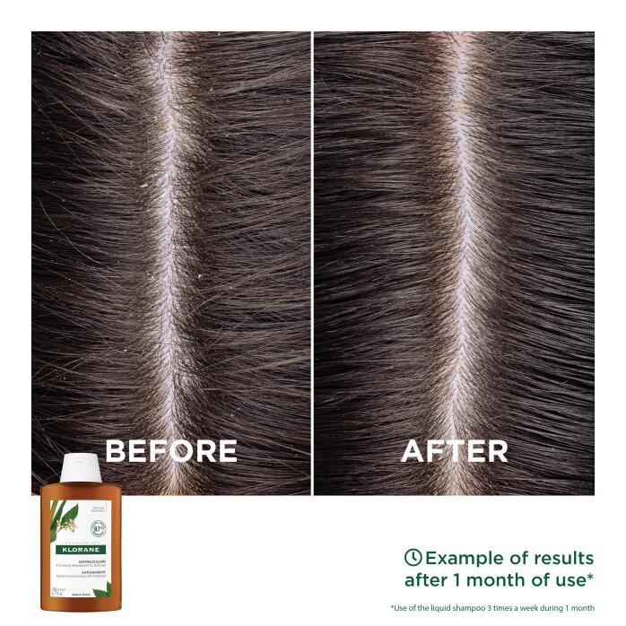 Results Anti-Dandruff Rebalancing Shampoo with Galangal