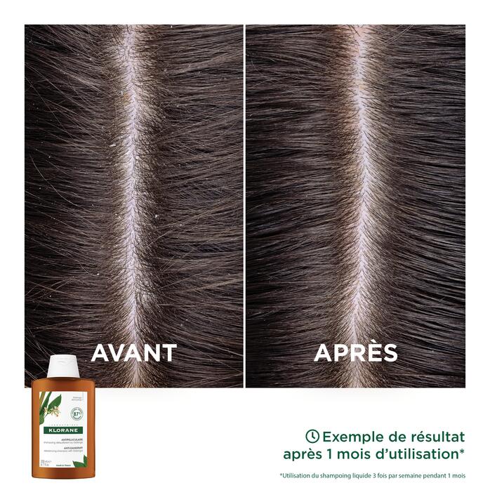 Résultats Shampoing rééquilibrant au Galanga