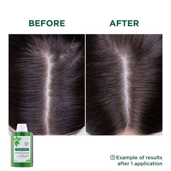 Résultats Shampoing à l’Ortie BIO