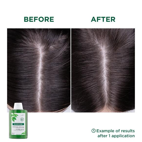 Αποτελέσματα Σαμπουάν με Βιολογική Τσουκνίδα για λιπαρά μαλλιά