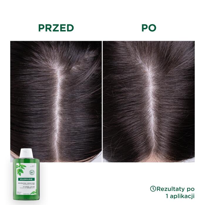 Wyniki Szampon z ORGANICZNĄ pokrzywą