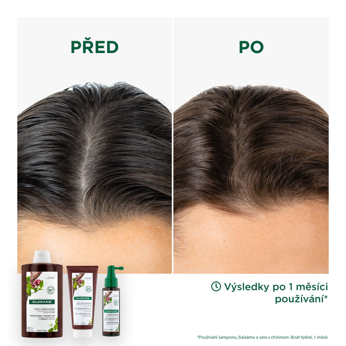 Výsledky Sérum s chininem a BIO protěží alpskou