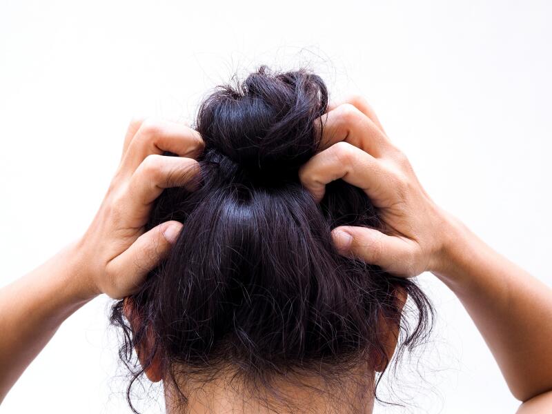 Hair loss and itchy scalp Ducray