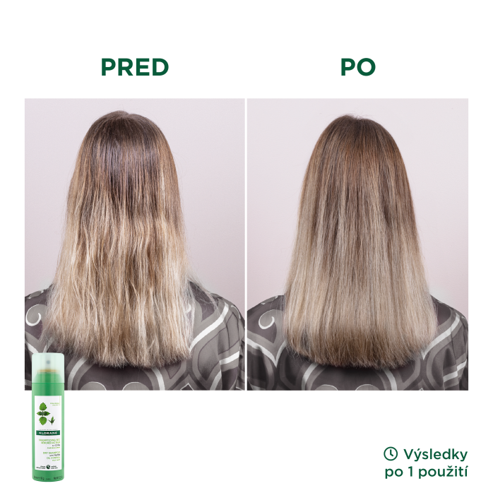 Výsledky Seboregulační suchý šampon s kopřivou