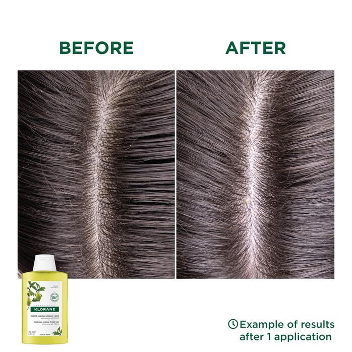 Resultaten Shampoo met Cederappel