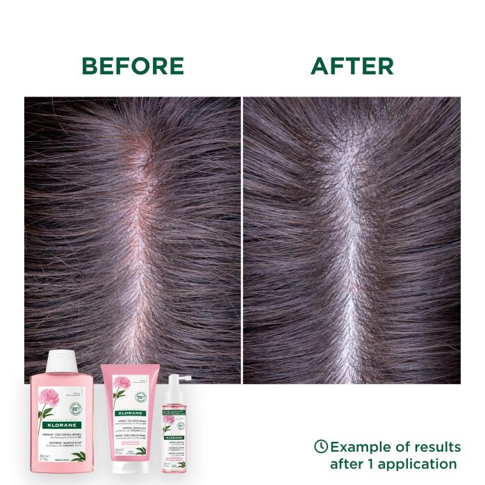 Risultati Shampoo alla Peonia BIO