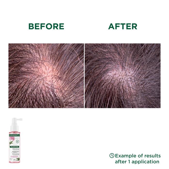 Results Soothing serum with ORGANIC Peony