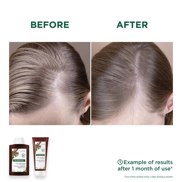 Results Conditioner with Quinine & ORGANIC Edelweiss 