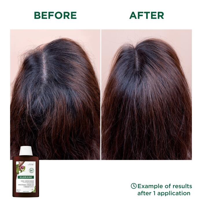 Résultats Shampoing à la Quinine & Edelweiss BIO