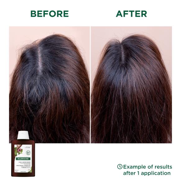 Results Shampoo with Quinine and ORGANIC Edelweiss
