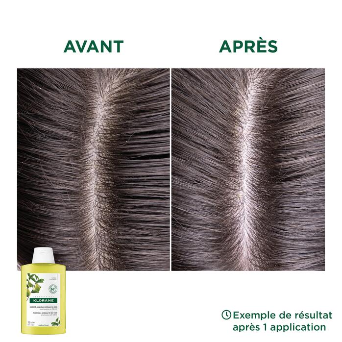Résultats Shampoing au Cédrat