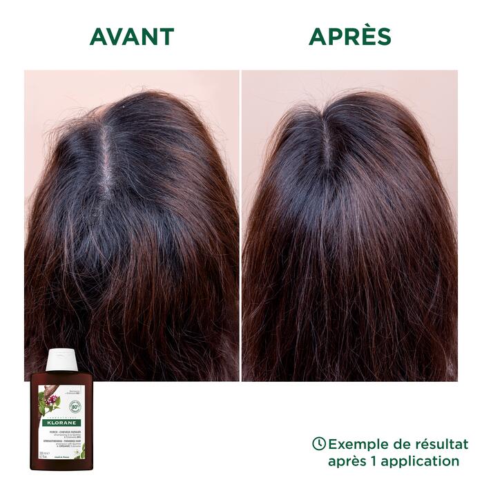 Résultats Shampooing force à la Quinine et Edelweiss BIO