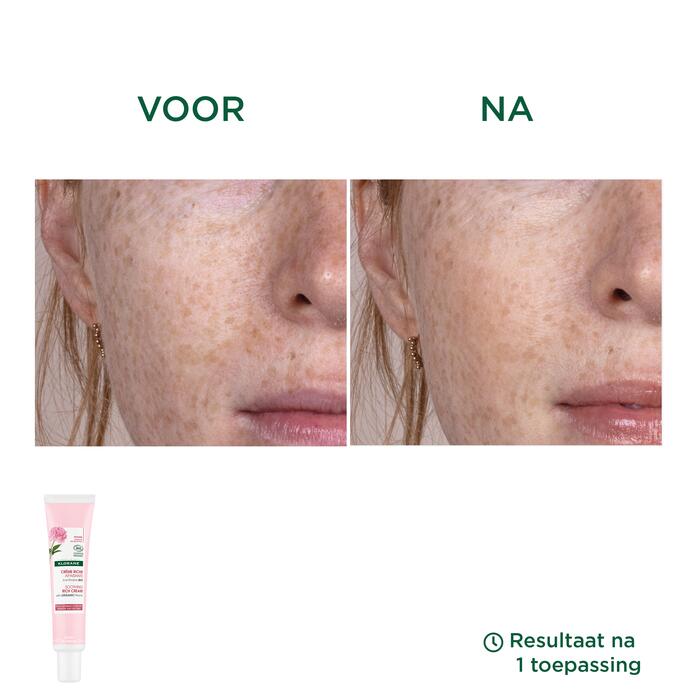 Resultaten Rijke Kalmerende Crème met BIO Pioenroos - Gevoelige en droge huid