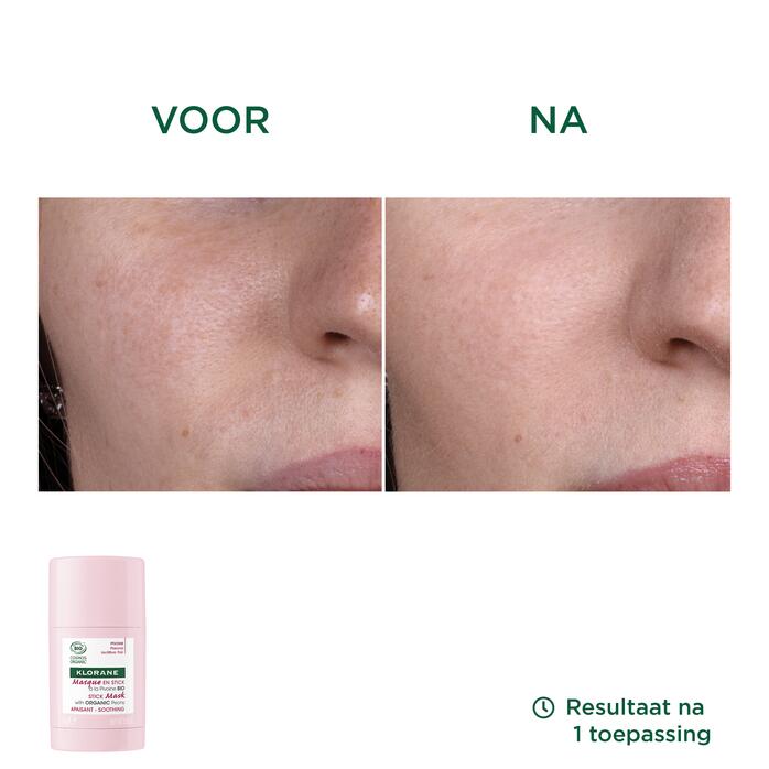 Resultaten Verzachtend Masker in stickvorm met BIO Pioenroos - Gevoelige huid