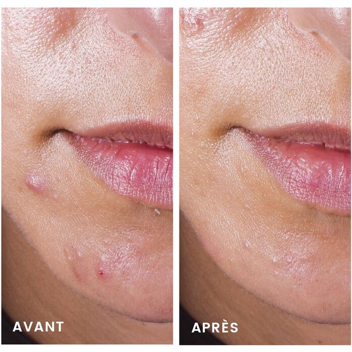 Résultats COMEDOMED Concentré anti-imperfections