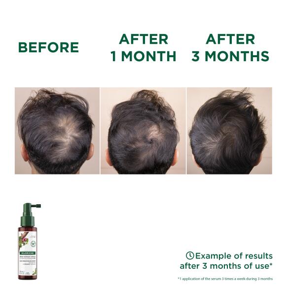 Results Hair Strengthening Serum with Quinine and ORGANIC Edelweiss
