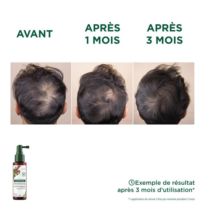 Résultats Sérum à la Quinine & Edelweiss BIO