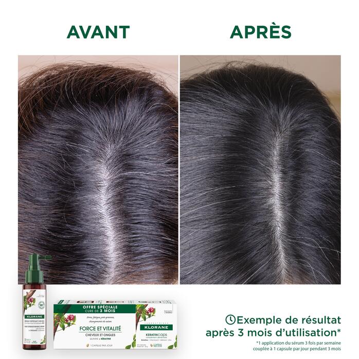 Résultats Complément alimentaire KeratinCaps à la Quinine et Kératine