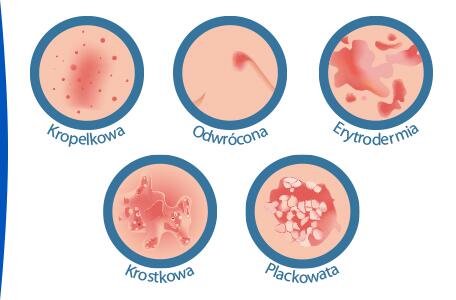 uszczyca-krostkowa-czym-jest-uszczyca-krostkowa-desc-ducray1