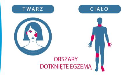 egzema-egzema-u-dzieci-ducray