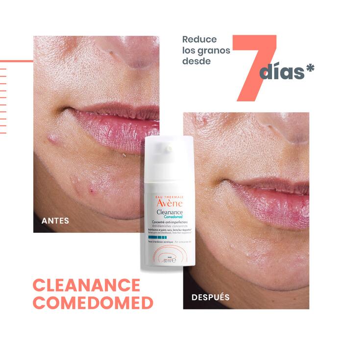 Resultados clínicos Eau Thermale Avène - Cleanance Comedomed Concentrado anti-imperfecciones