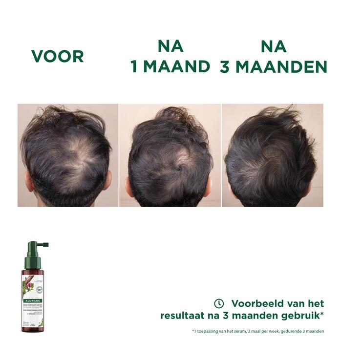 Resultaten Serum met Kinine en BIO Edelweiss