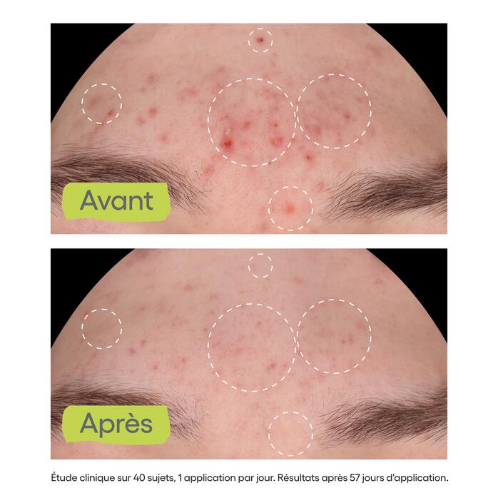 Résultats Sérum anti-imperfections 