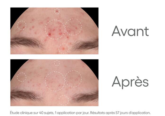 Efficacité prouvée Sérum anti-imperfections