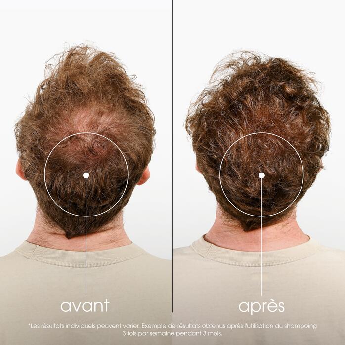 Résultats ANTICHUTE Shampoing fortifiant et stimulant