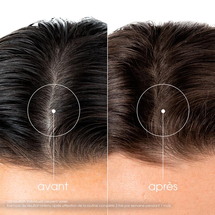 Résultats ANTICHUTE Shampoing fortifiant et stimulant