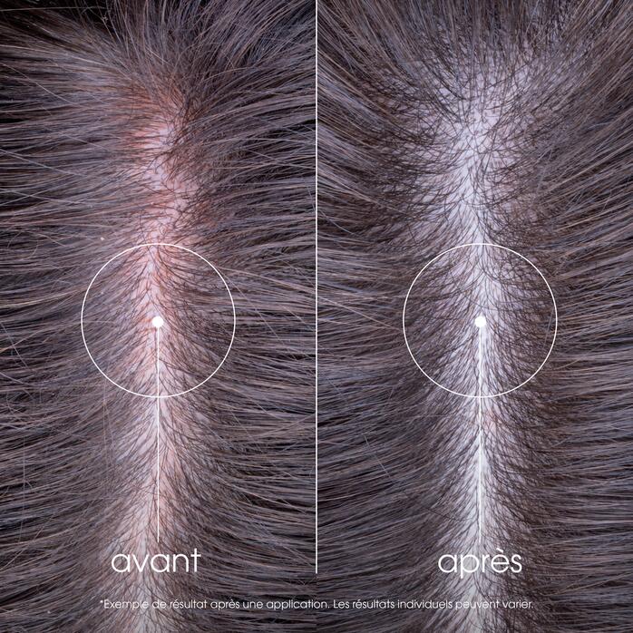 Résultats APAISANT Shampoing anti-irritation et protecteur
