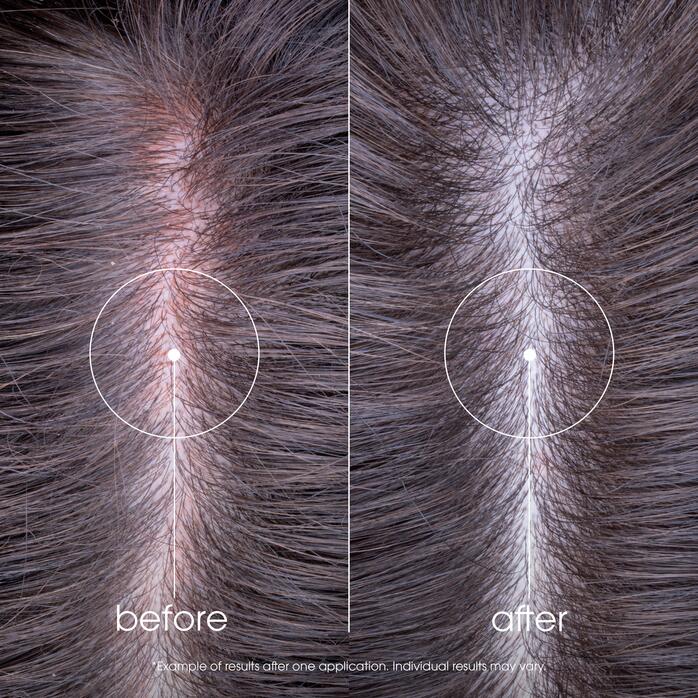 Ergebnisse Linderndes Haarserum bei Irritationen