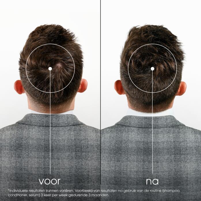Resultaten TEGEN HAARUITVAL Versterkende en stimulerende conditioner met Kinine