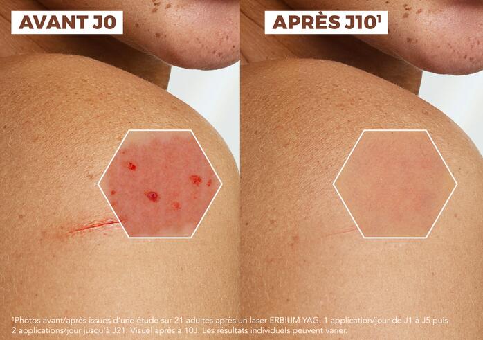 Efficacité prouvée Crème réparatrice anti-marques