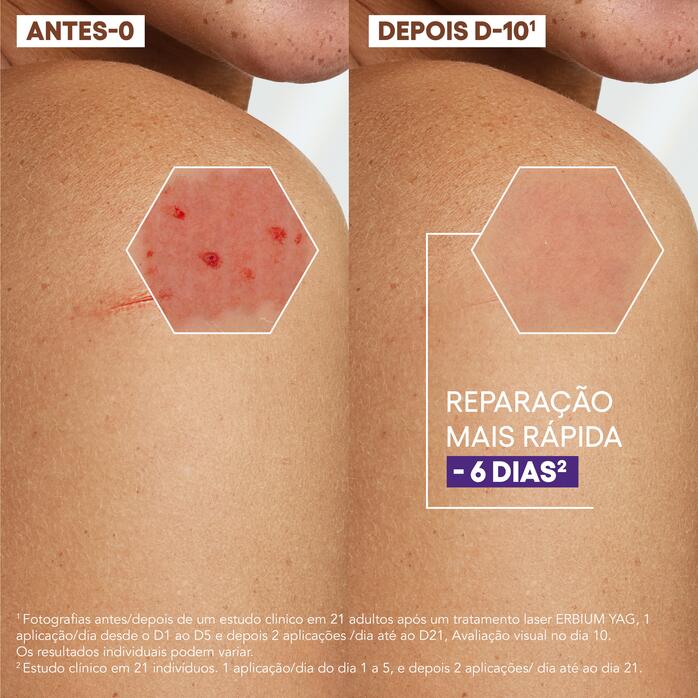 Eficácia comprovada Creme reparador antimarcas 