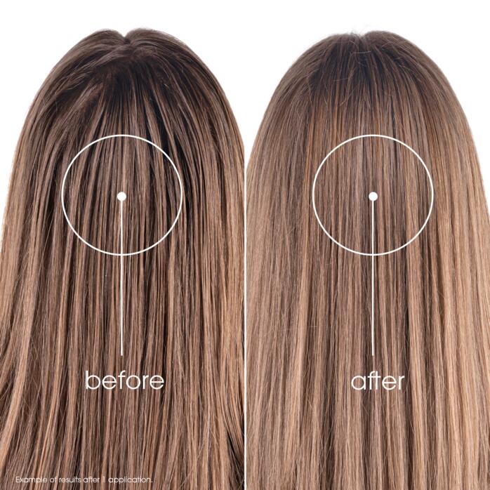 Results Dry Shampoo with Nettle & Vitamin E