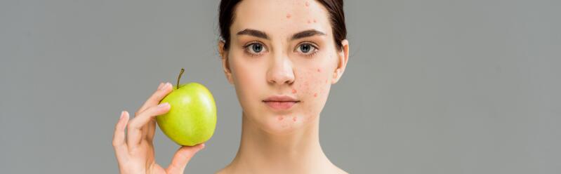 le-zinc-pour-lutter-contre-l-acne-ducray
