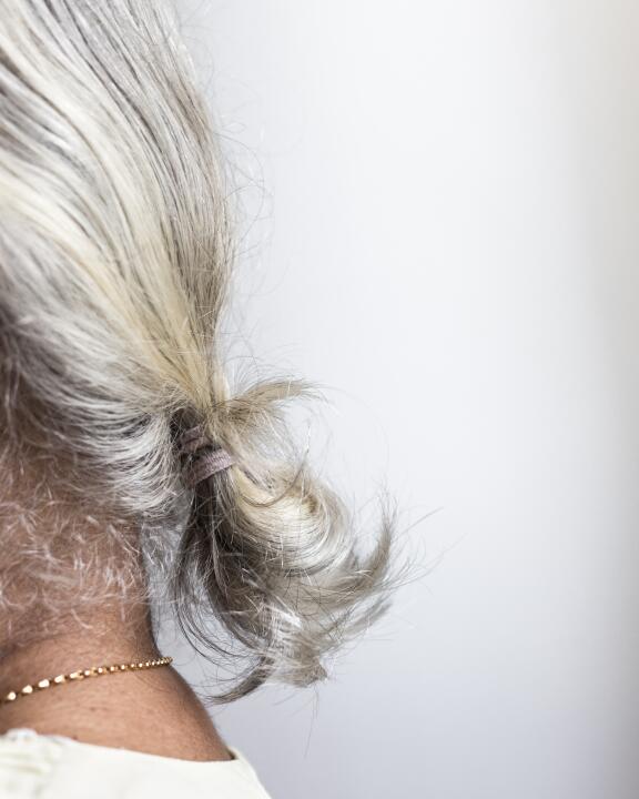 caida-del-cabello-o-alopecia-todo-lo-que-necesita-saber-enfoque-en-los-sintomas-de-la-alopecia-androgenetica-ducray