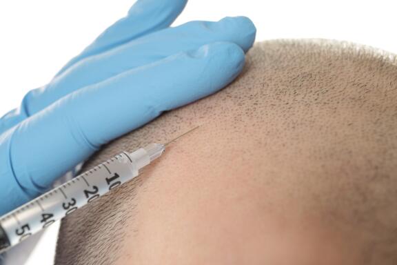 how-to-fight-hair-loss-what-to-do-for-alopecia-ducray