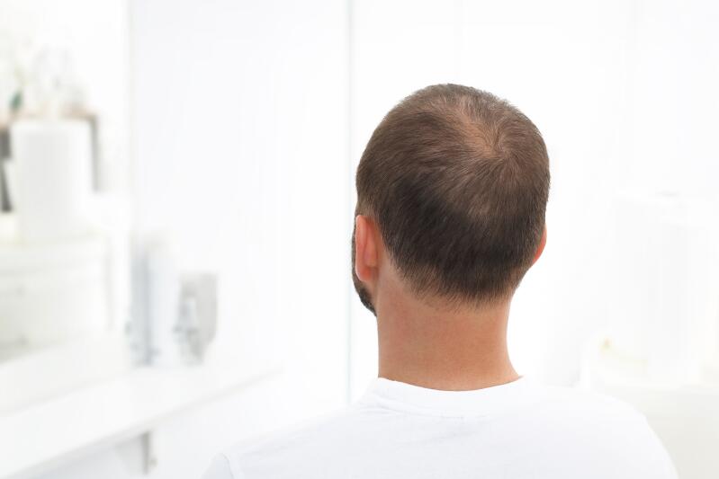 l-alopecie-androgenetique-chez-la-femme-et-chez-l-homme-ducray