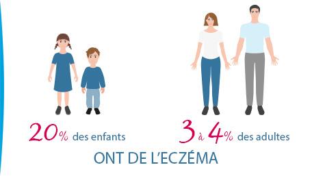 eczema-causes-symptomes-traitements-que-faut-il-savoir-sur-l-eczema-ducray