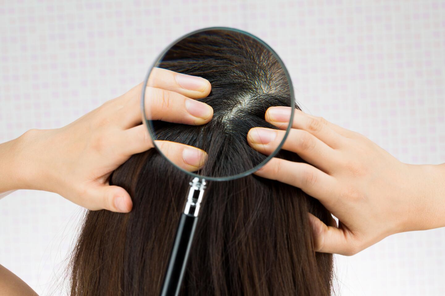hvad-er-en-sensitiv-hovedbund-ducray-upper-image