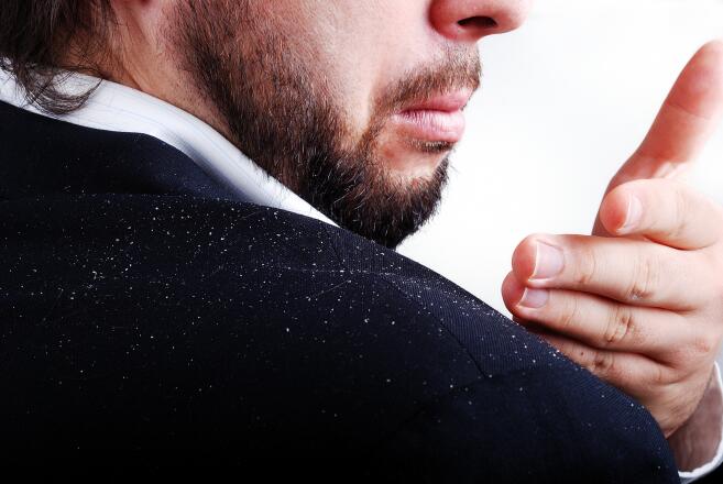 simple-dandruff-conditions-ducray-upper-image
