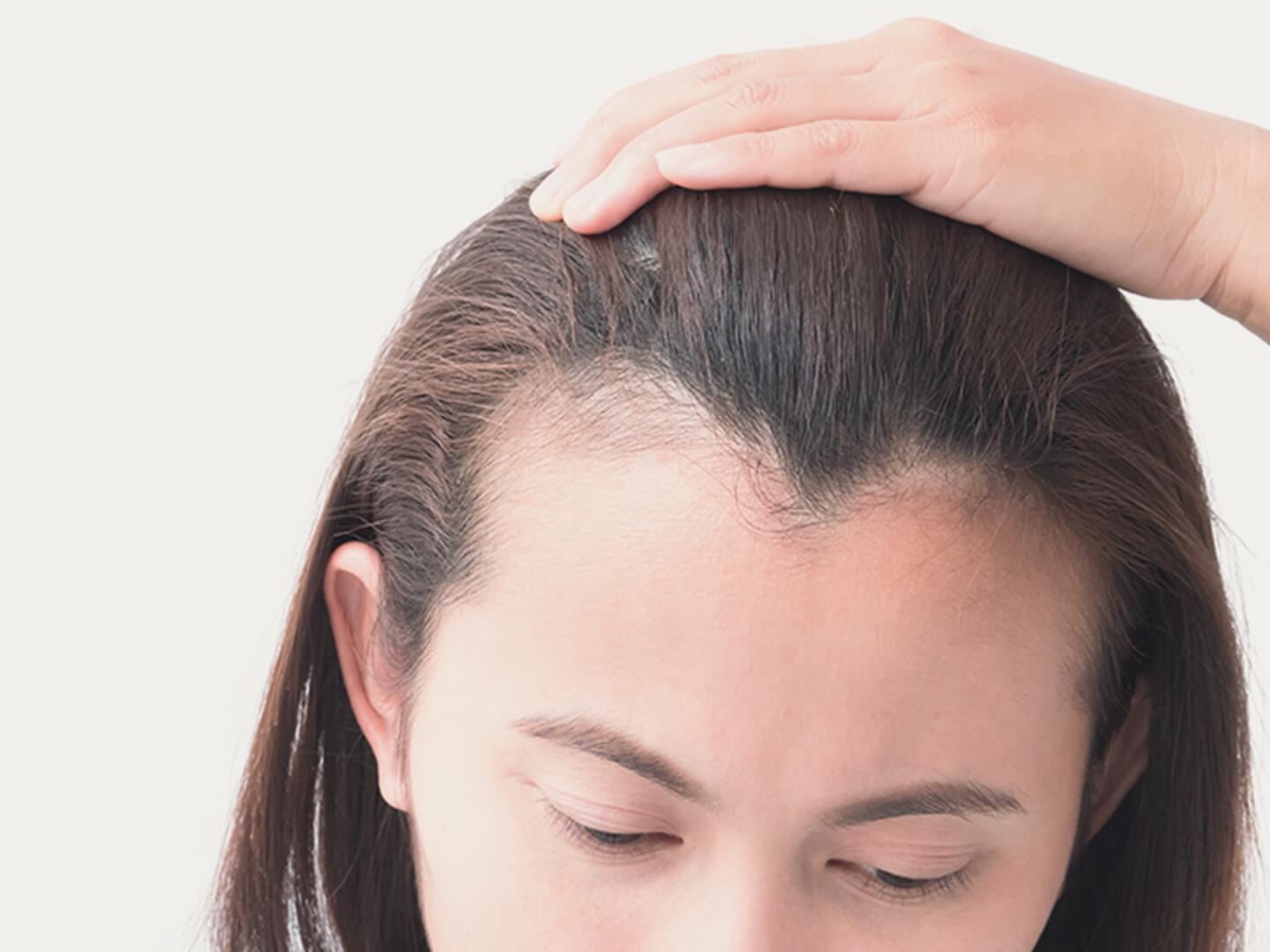 DU_Geheimratsecken_bei_der_Frau_textmodul1