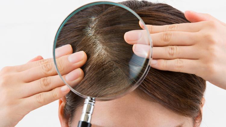 DU_sensible_skin_hair_scalp_diagnosis_WEBSITE_Italy