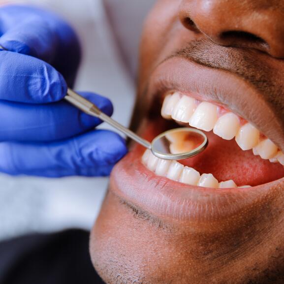 Възстановяват ли се венците?