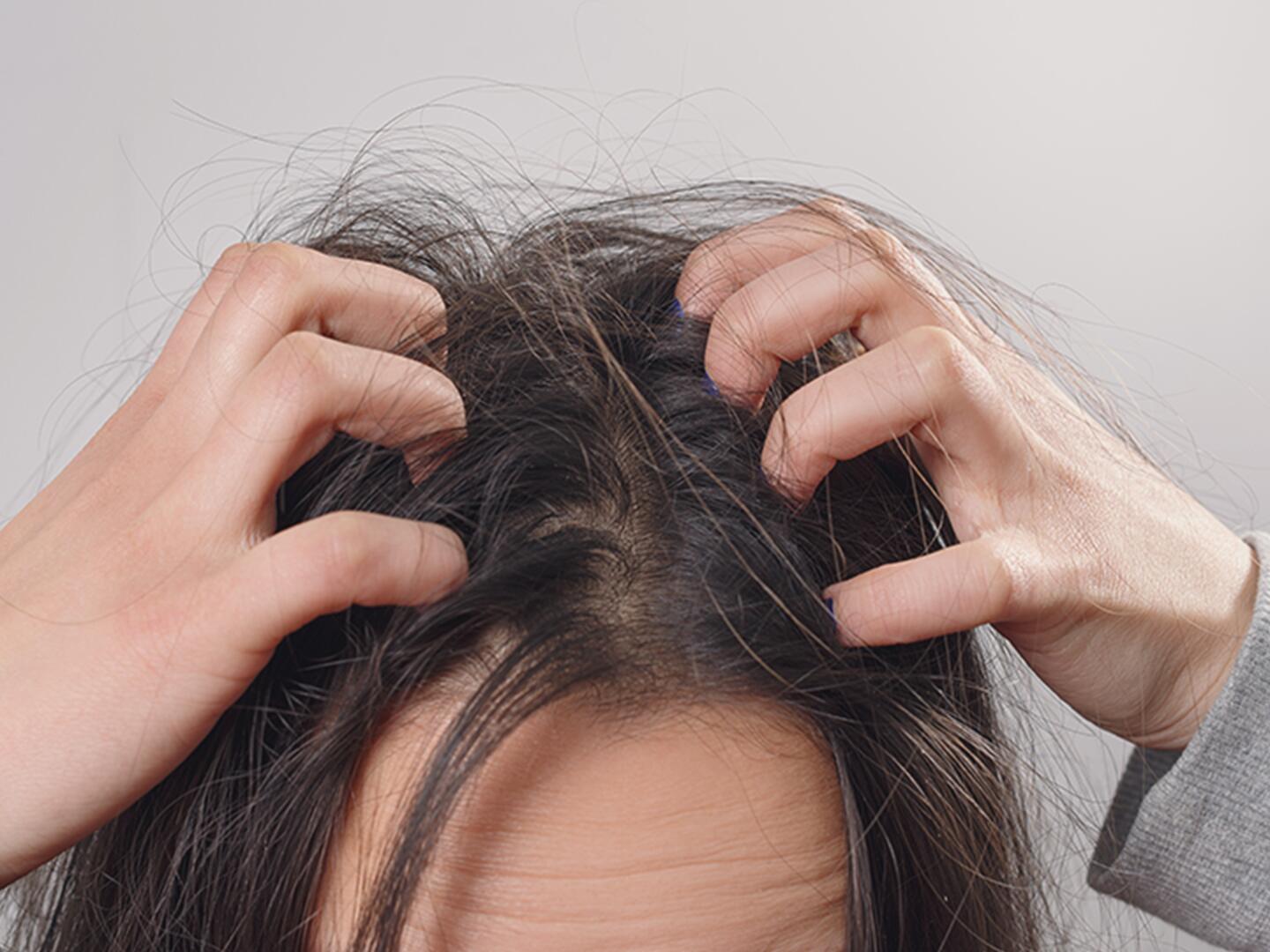 Почесывание затылка. Чистая кожа головы. Жирные волосы на затылке. Как убрать зуд головы. Чистые волосы.