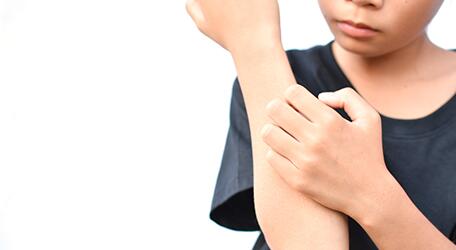 du_neurodermitis_silo_juckreiz