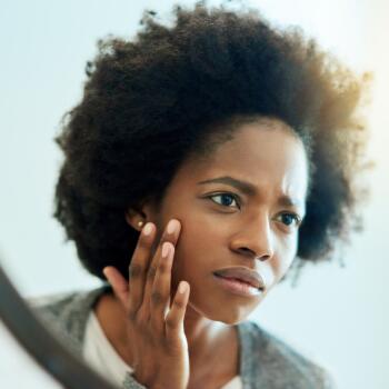 Todos os nossos conselhos sobre como cuidar da pele de tendência acneica